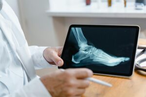 Doctor examining a foot X-ray image on a digital tablet using a stylus in a medical office.